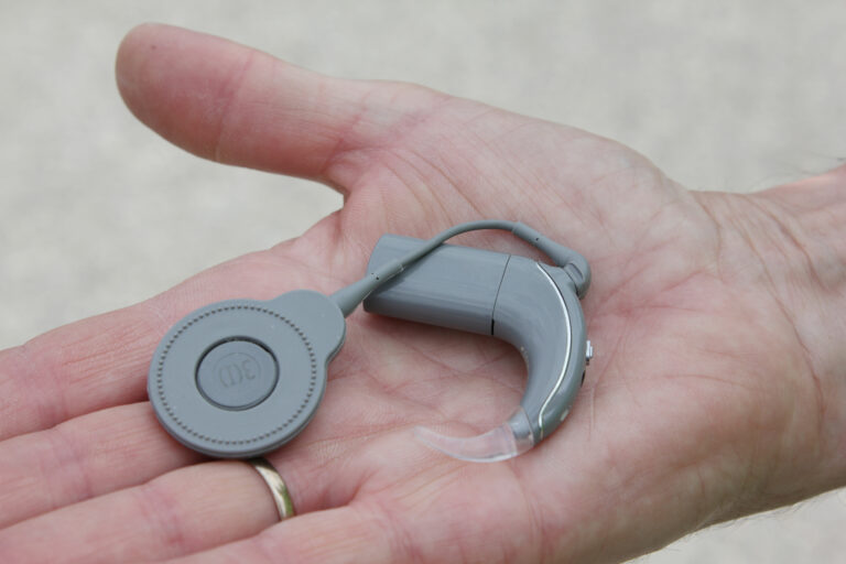 Das Cochlea-Implantat (Symbolbild) ist eine Hörprothese für Gehör­lose und Ertaubte, deren Hörnerv als Teilorgan der auditiven Wahrnehmung noch funktionsfähig ist, sowie für hochgradig Schwerhörige, bei denen die Versorgung mit einem Hörgerät nicht mehr ausreichend ist. Foto: Sarah/stockAdobe.com